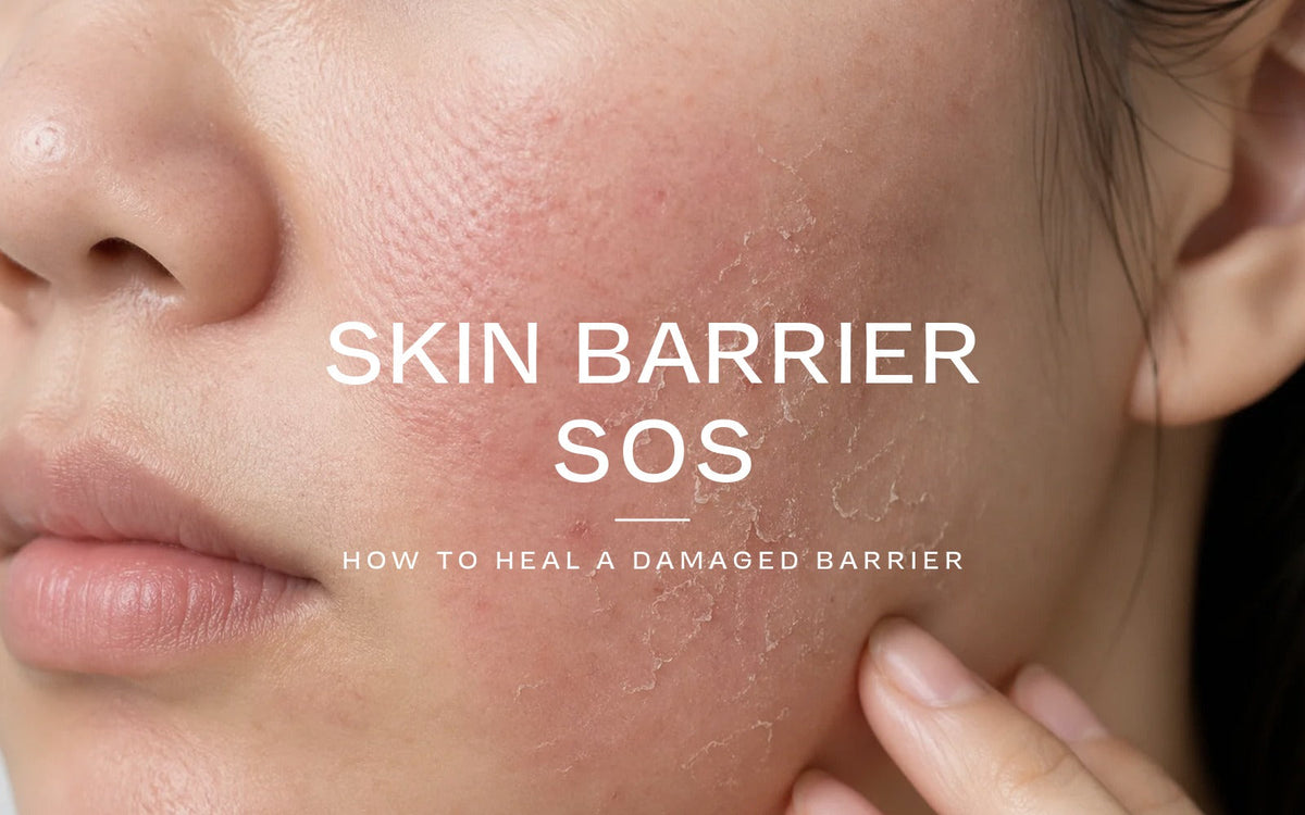 Skin Barrier SOS: how to heal a damaged skin barrier