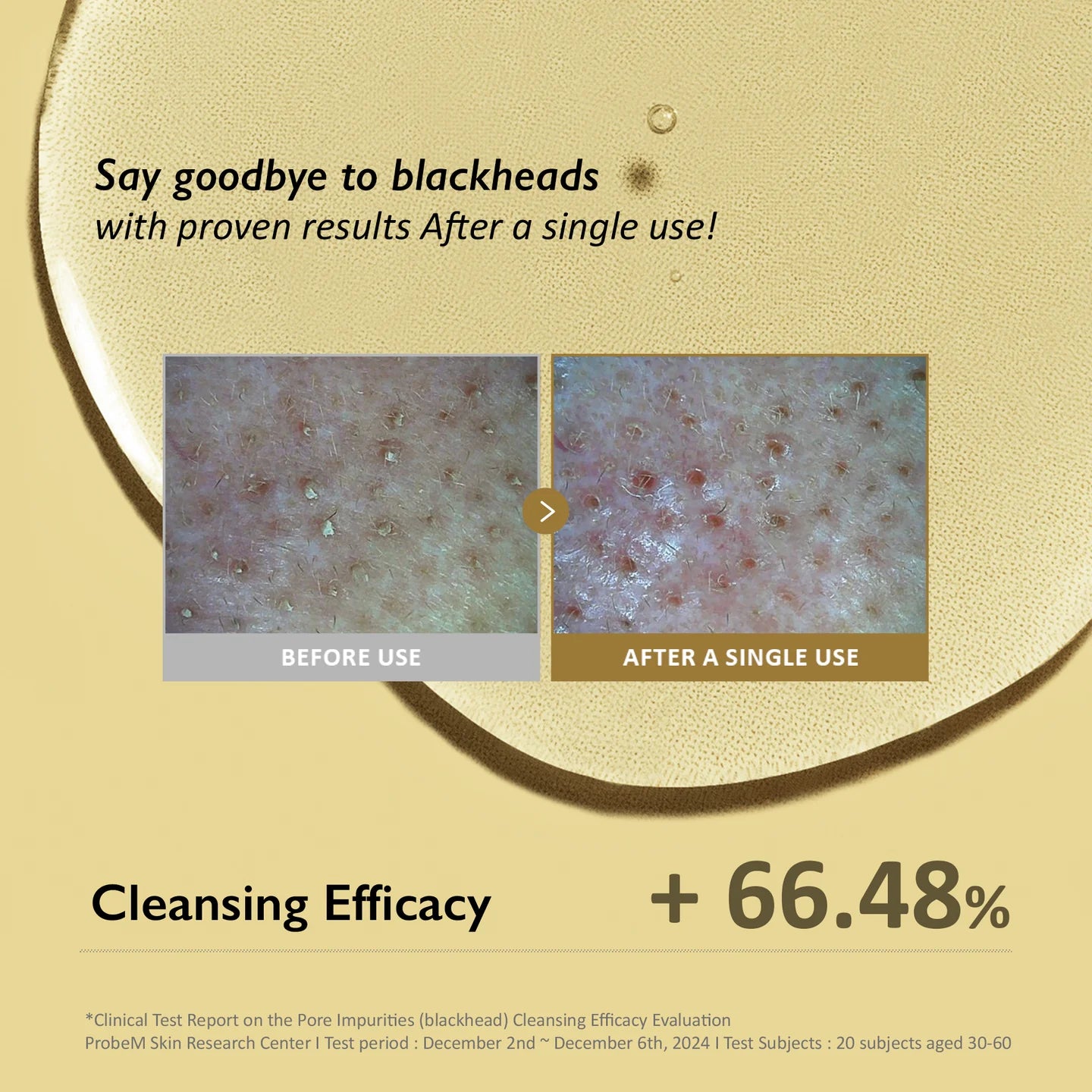 HARUHARU WONDER - Wonder Black Rice Moisture Deep Cleansing Oil 150ml