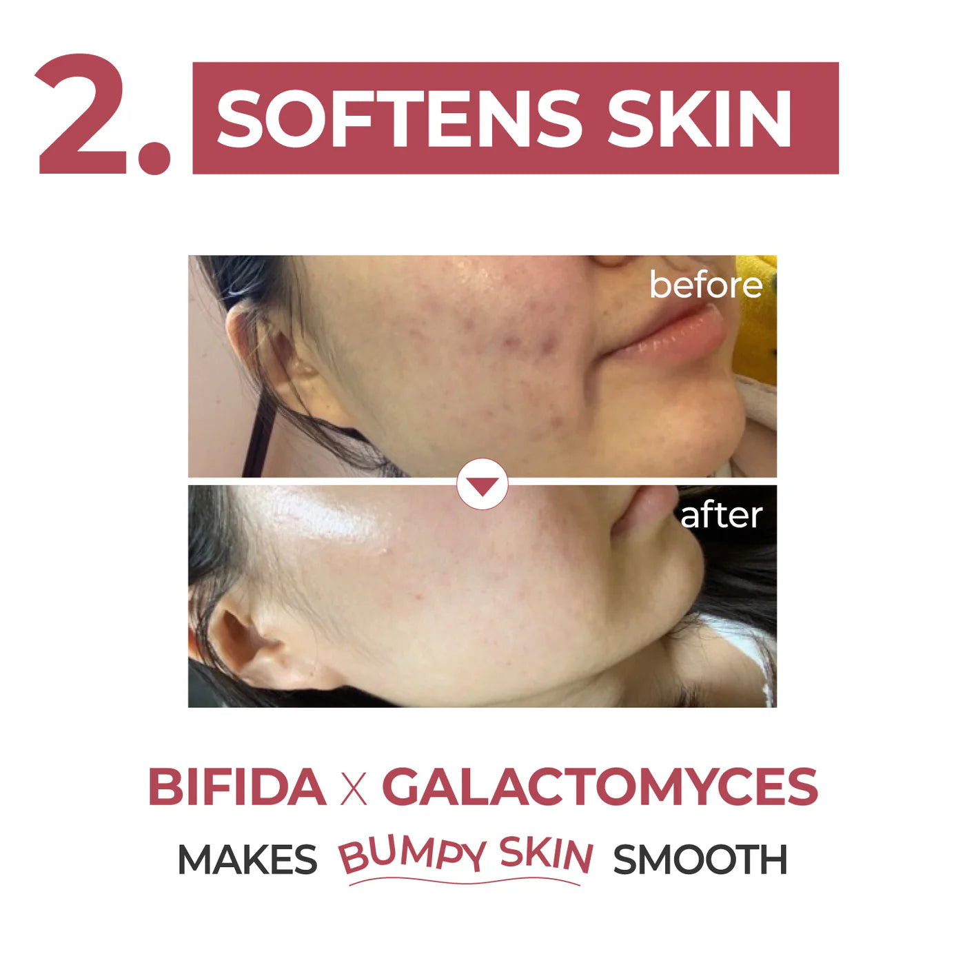 NUMBUZIN - No.3 Skin Softening Serum 50ml