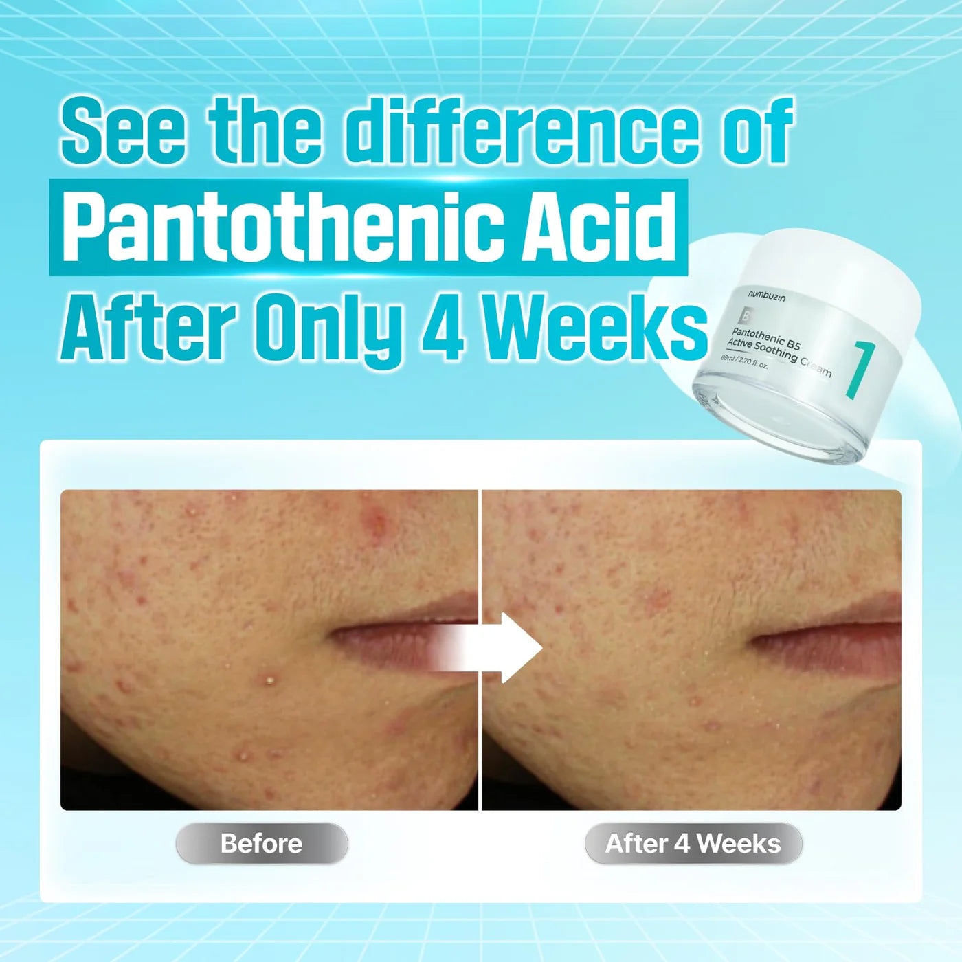 NUMBUZIN - No.1 Pantothenic B5 Active Soothing Cream