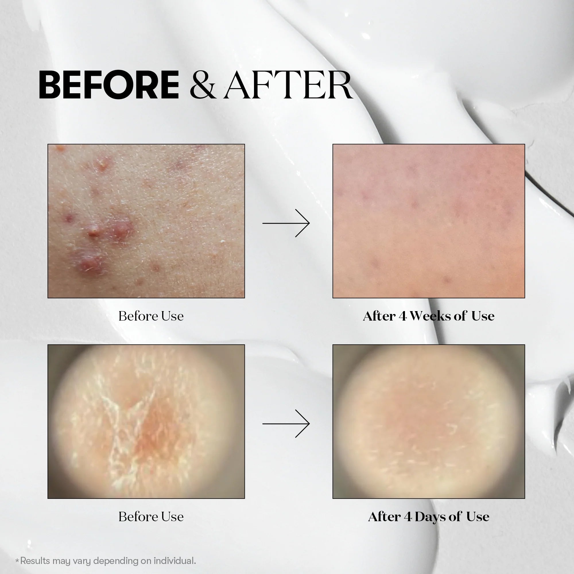 VT COSMETICS - Mild Reedle Shot 50
