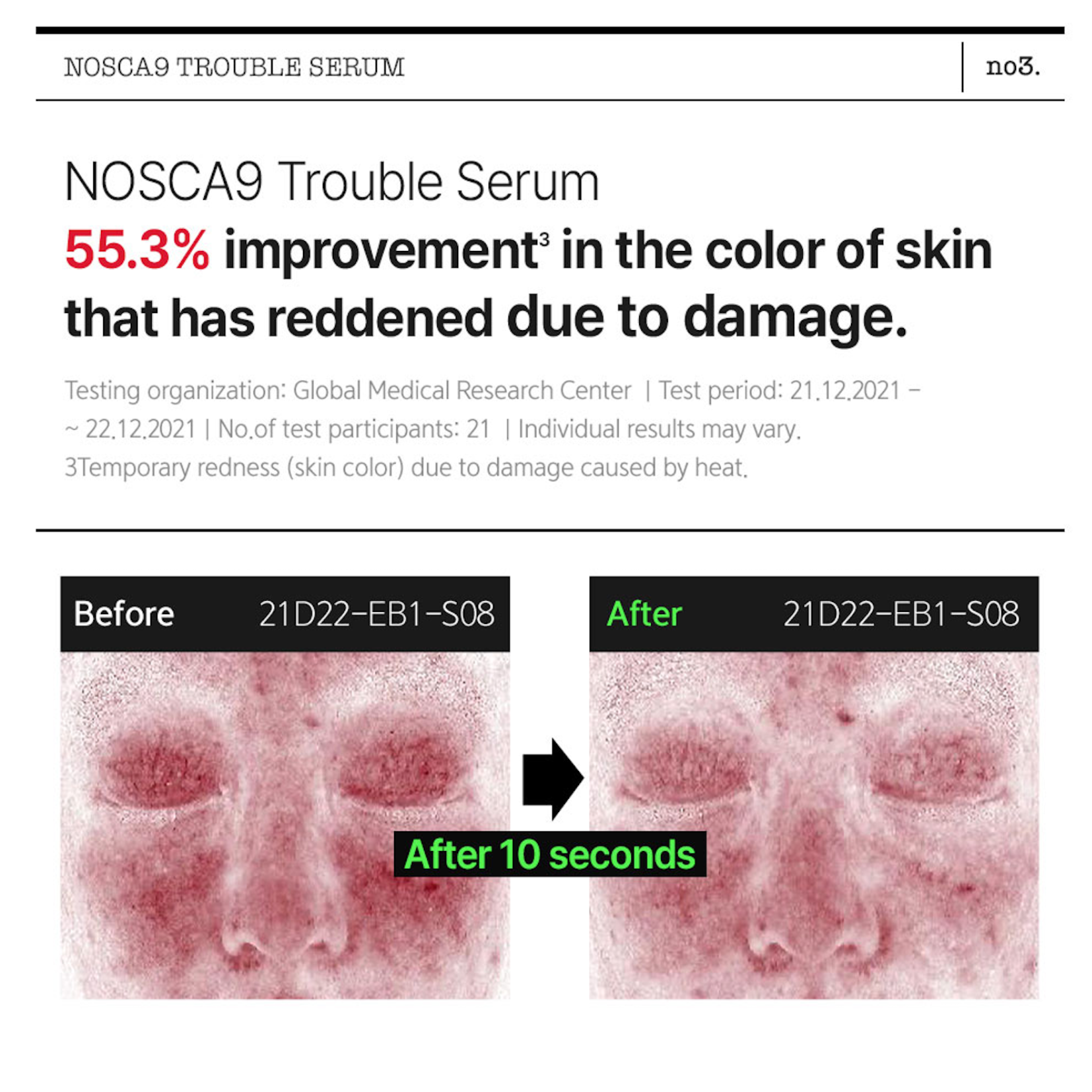 FATION - Nosca9 Trouble Serum 30ml