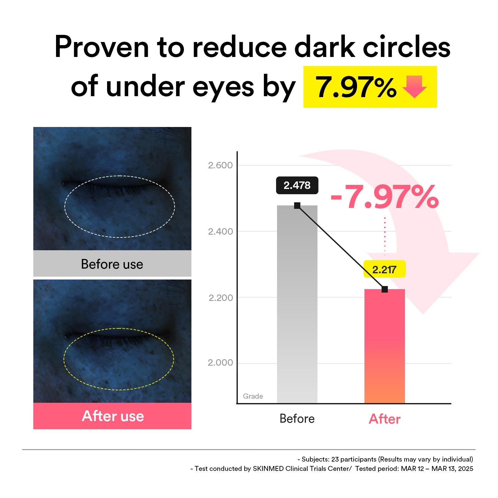 ABIB - PDRN Retinal Eye Patch Glow Jelly (60 pezzi)