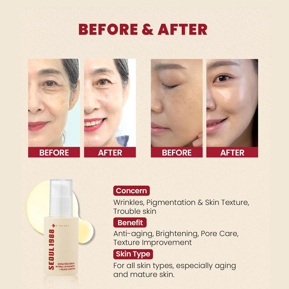 KSECRET - SEOUL 1988 Serum : Retinal Liposome 2% + Black Ginseng 30ml