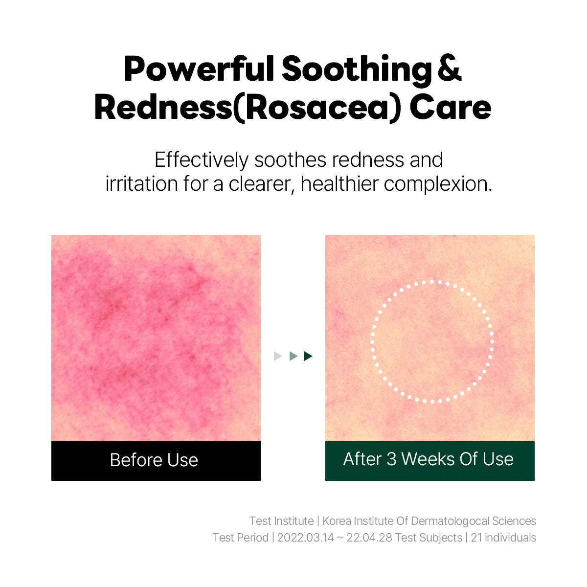 ROUND LAB - Pine Calming Cica Ampoule 30ml