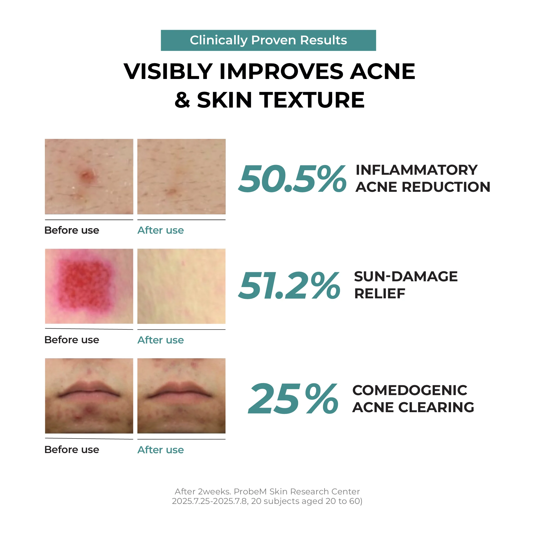 JUMISO - Snail Mucin 95 + Peptide Facial Essence 140ml