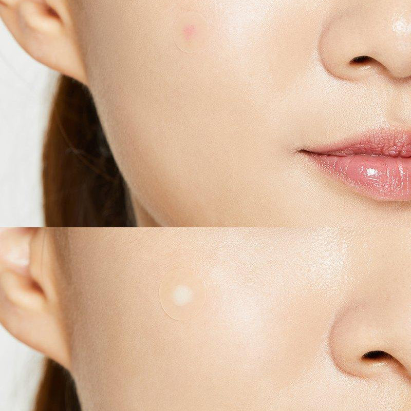 COSRX - Acne Pimple Master Patch
