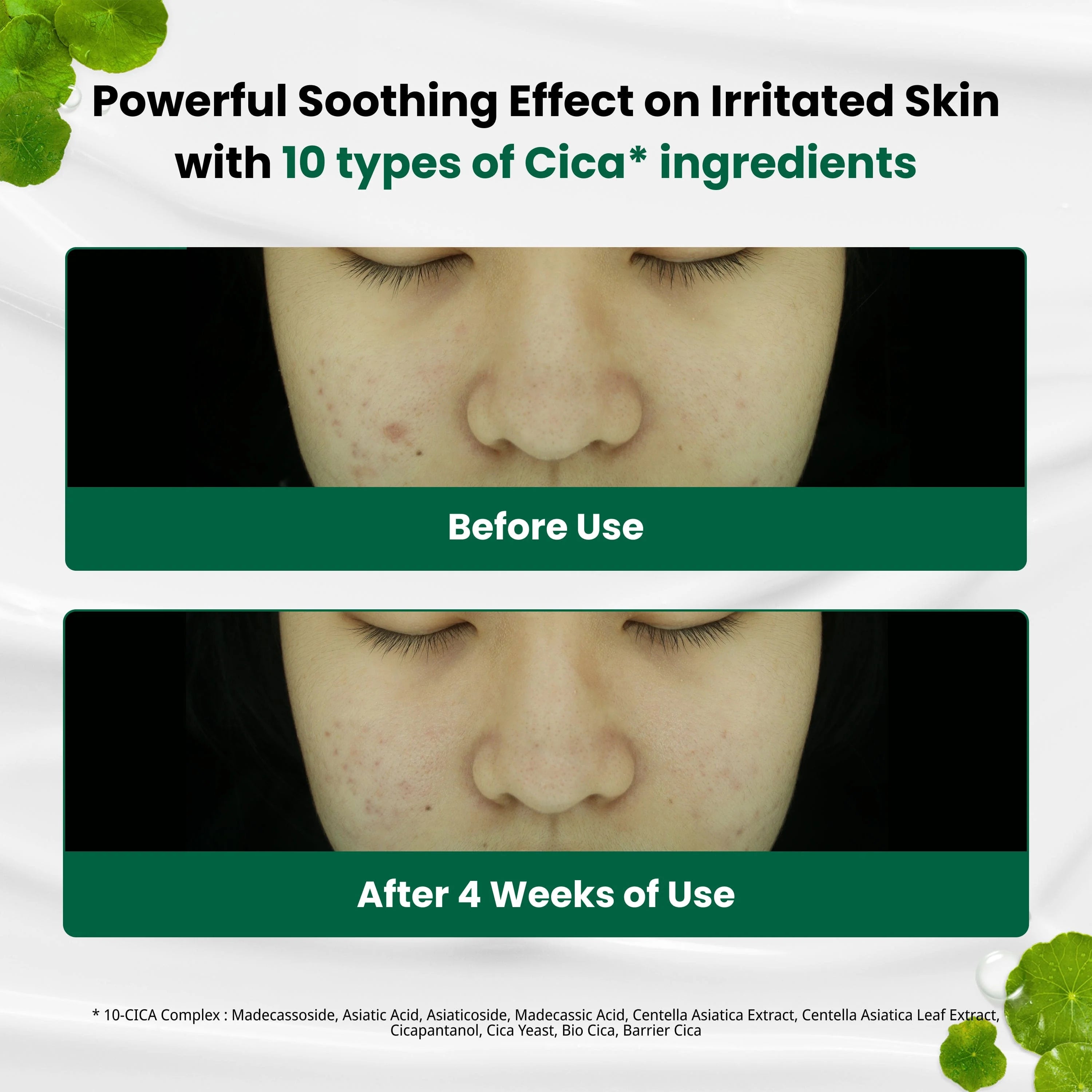 DR.G - Red Blemish Deep Soothing Mask