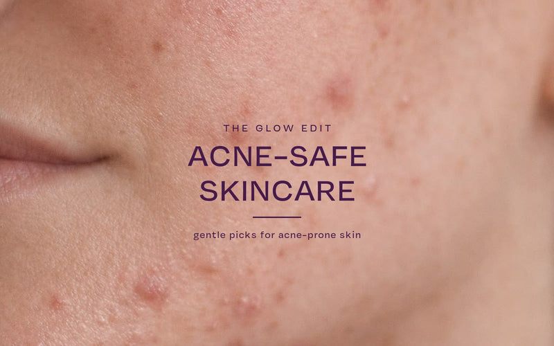 Acne-Safe Skincare: gentle products for acne-prone & sensitive skin