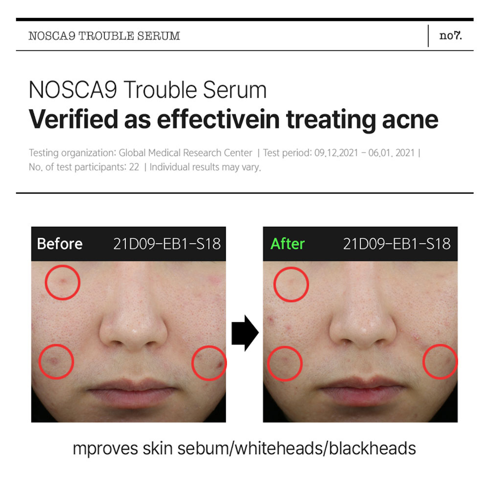 FATION - Nosca9 Trouble Serum 30ml