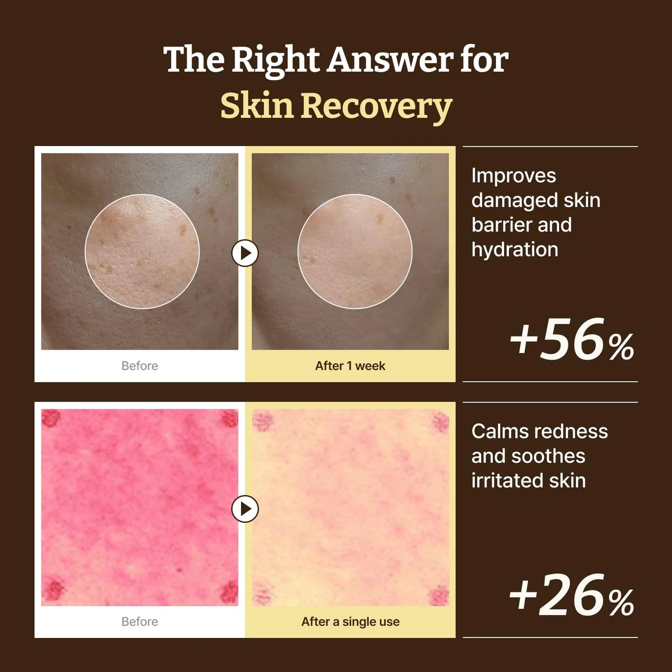 DR. REJU-ALL - Advanced PDRN Rejuvenating Cream 20g