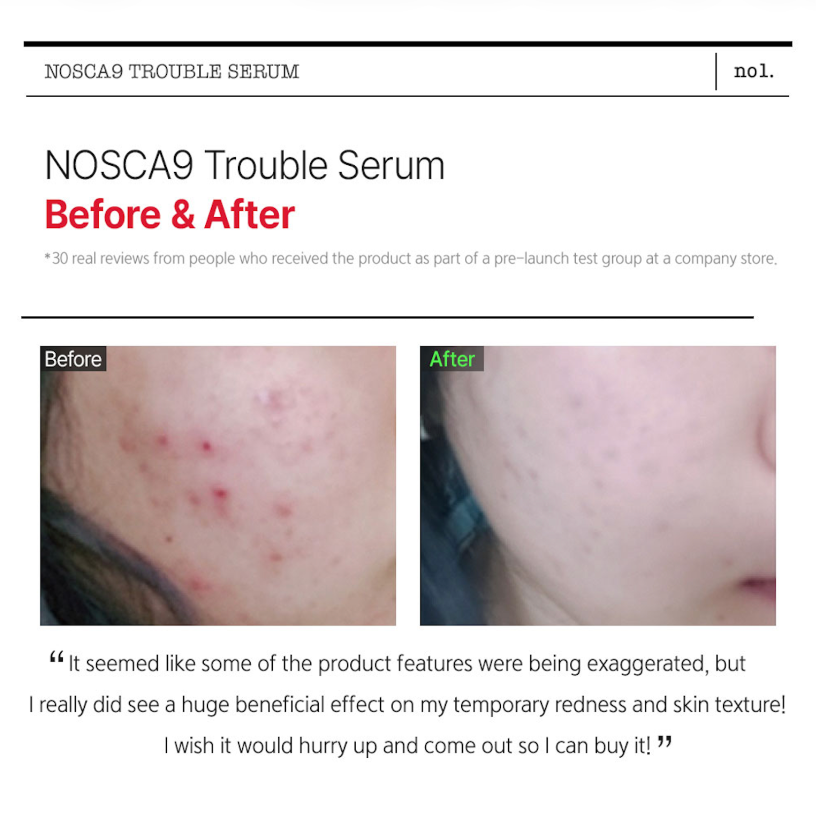 FATION - Nosca9 Trouble Serum 30ml