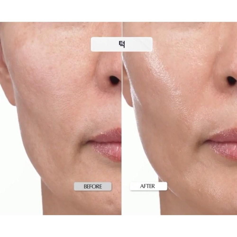 KOPHER- Curepair Melder Sos System 30ml (1.5ml*5ea)*4