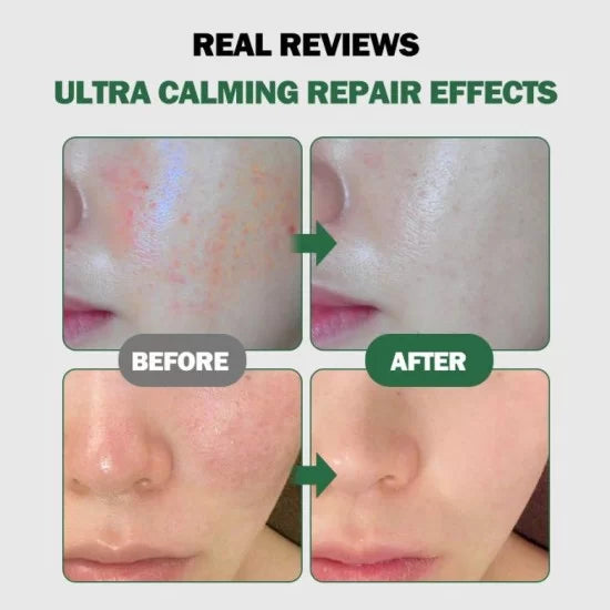 MEDIPEEL - Phyto Cica-Nol B5 Calming Drop Gel Cream 50ml