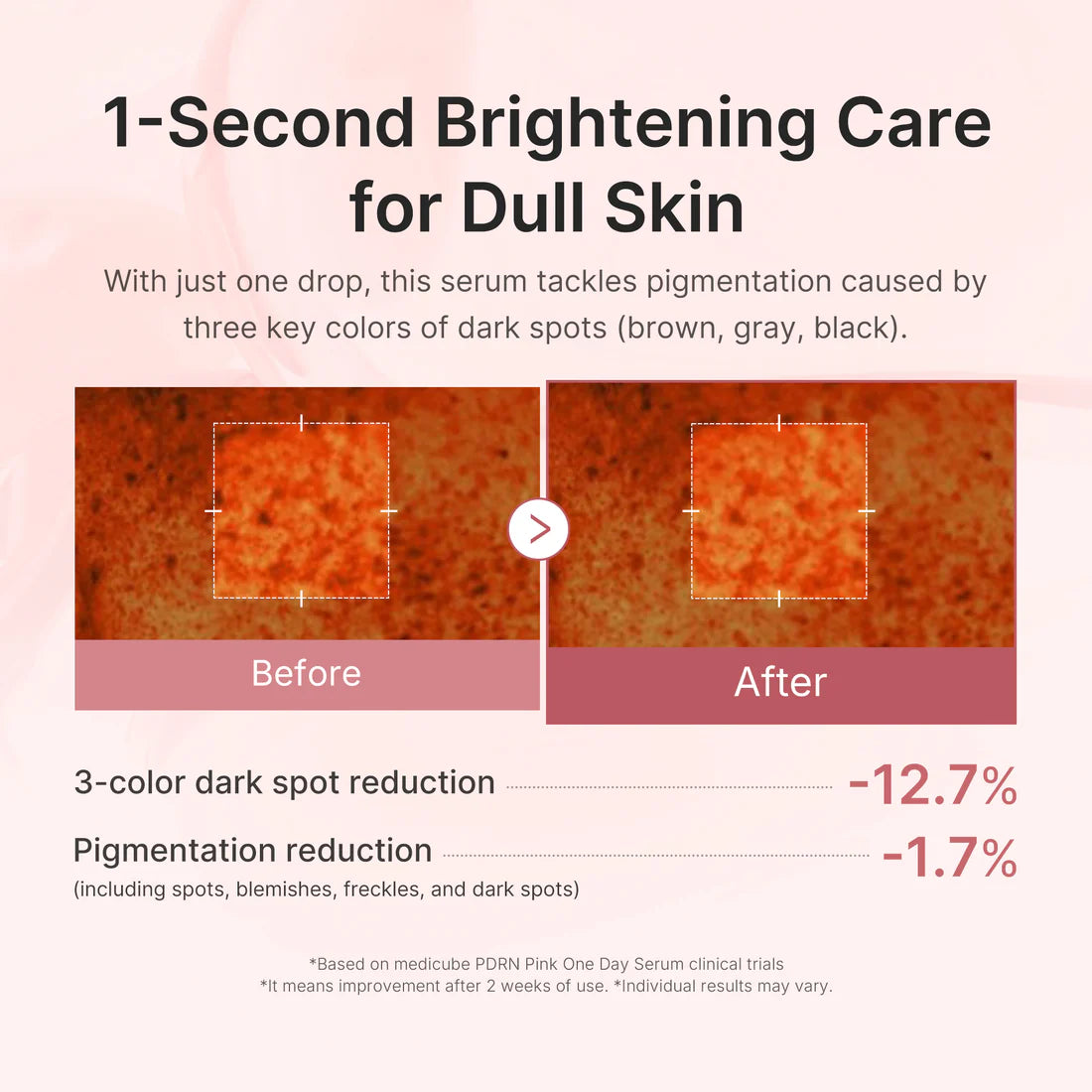 MEDICUBE - PDRN Pink One Day Serum 10ea