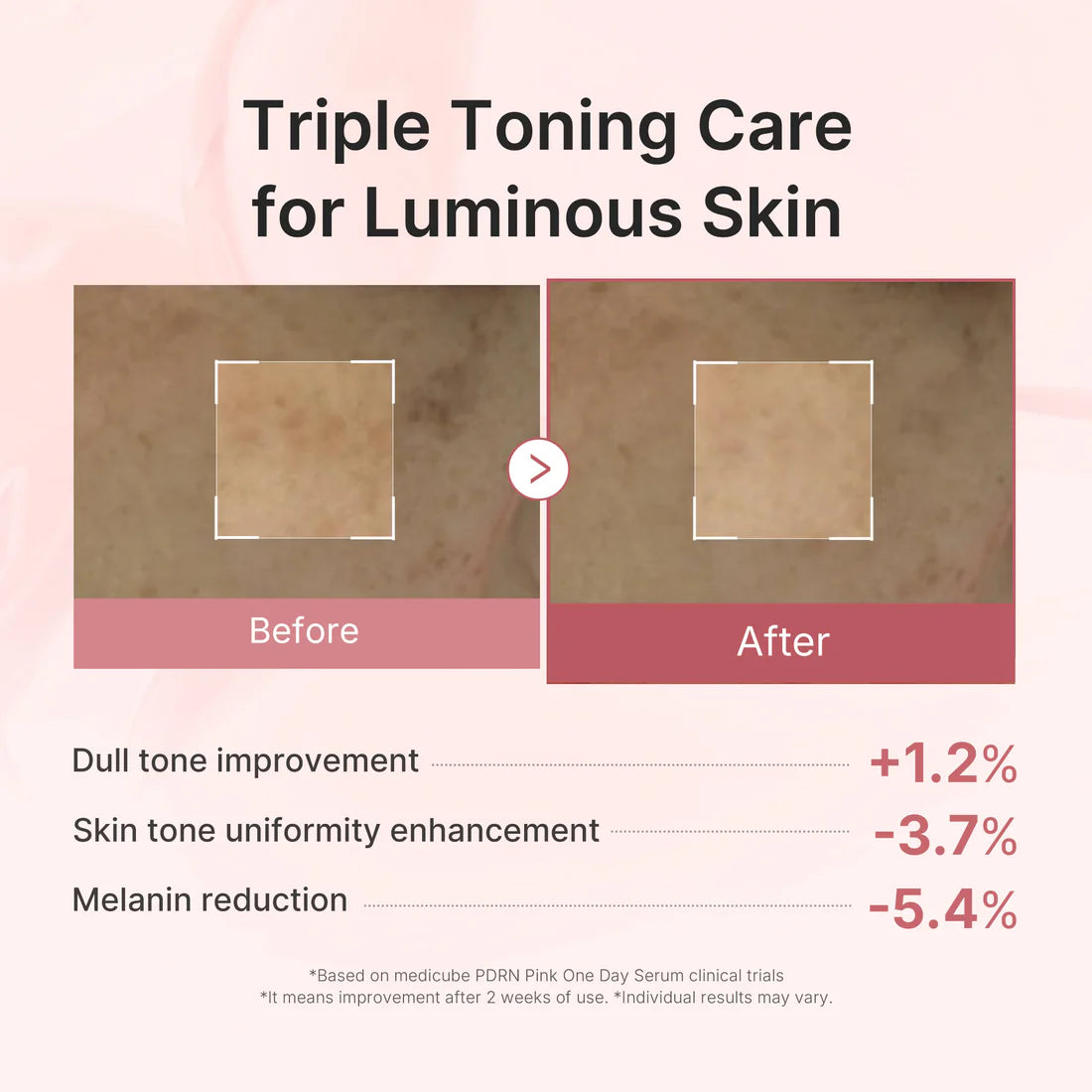 MEDICUBE - PDRN Pink One Day Serum 10ea
