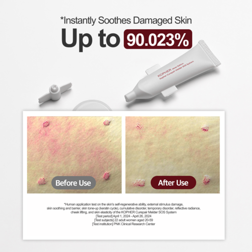 KOPHER - Curepair Melder Sos System 30ml (1.5ml*5ea)*4