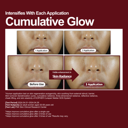 KOPHER - Curepair Melder Sos System 30ml (1.5ml*5ea)*4