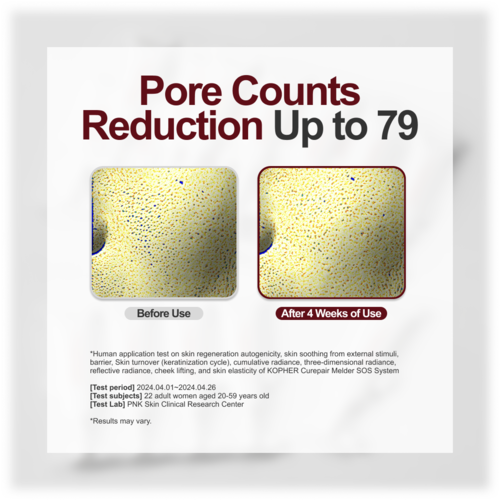 KOPHER - Curepair Melder Sos System 30ml (1.5ml*5ea)*4