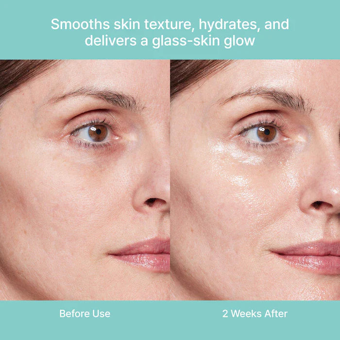 REJURAN - Turnover Ampoule 30ml